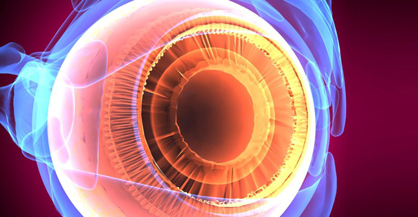 Corneal Transplant Surgery and DSEK