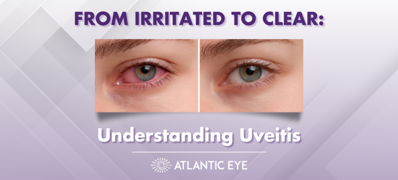 Graphic image comparison of red eyes versus clear eyes