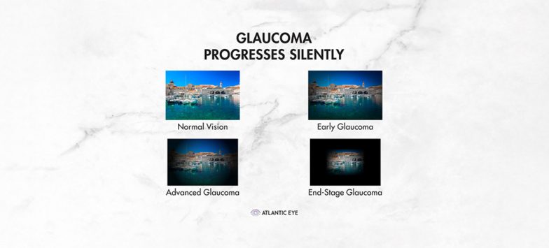 Glaucoma graphic comparison