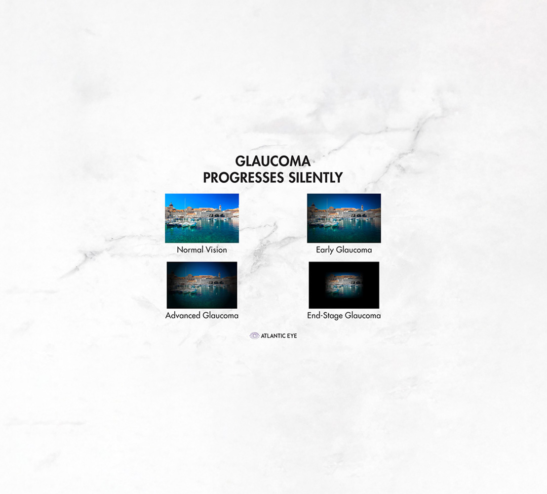 Glaucoma graphic comparison